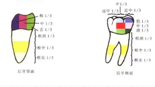 牙体解剖牙的三等分,补牙镶牙,牙体解剖,补牙,牙科网www.yadashi.com