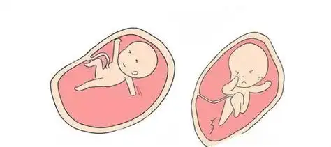 8个月胎儿在肚子里姿势