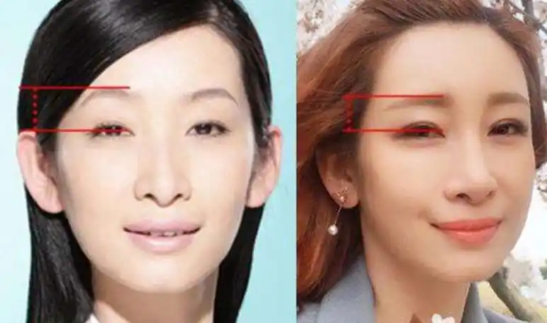 秦海璐是因为特殊原因去整容,那么戚薇就是纯粹为了更上镜.