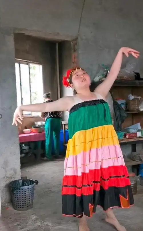 噩耗穿古装跳舞的胖女孩旧疾复发血小板变少全身出血很危急