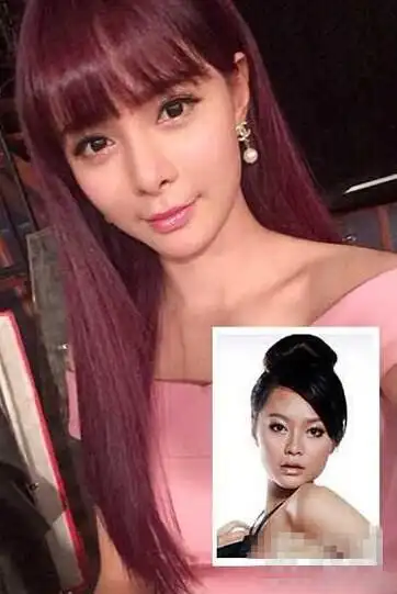 疑沈梦辰整容前后对比照疑沈梦辰整容前照片疑沈梦辰整容前后对比照