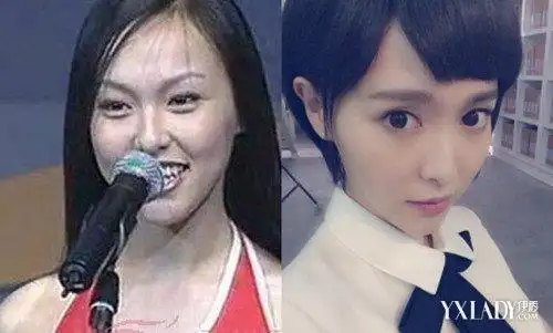 唐嫣整容前后照片对比原来以前长这样