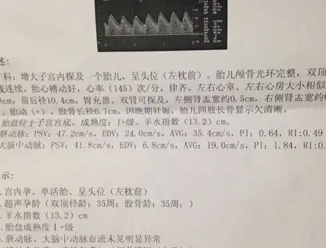 b超单上的一些信息,或许透漏了宝宝的"性别",孕妈别错过_胎儿_时候