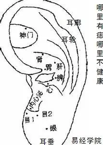 女人耳朵的痣与命运图女人耳朵前长痣面相图
