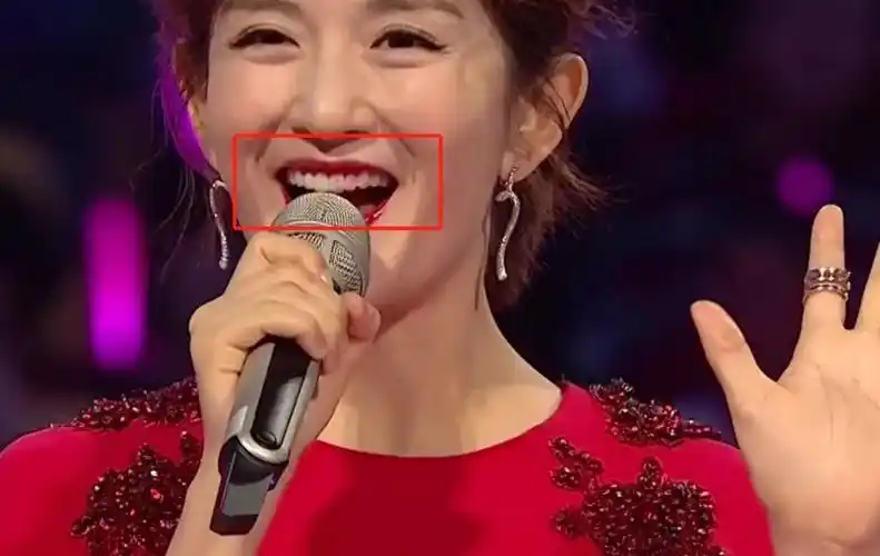 谢娜好像口红沾牙上了!