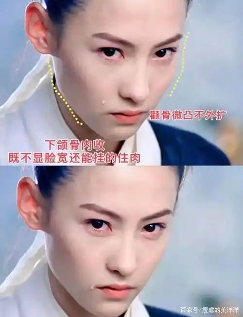 张柏芝为什么不会老