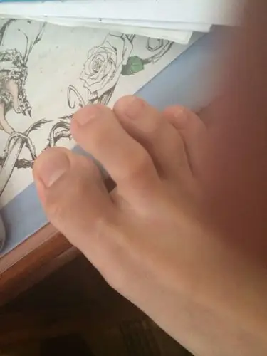 请问有那位(只限在校生)的脚趾是"二脚趾比大脚趾长的