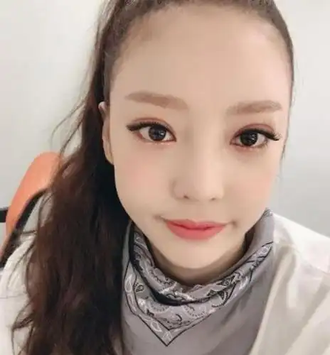 "做眼睑下垂手术有罪吗?"具荷拉自拍照片引争议