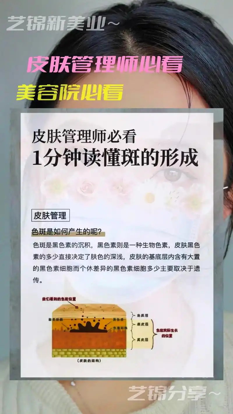 1分钟读懂班的形成.#抖音图文来了 #问题性皮肤管理 #干货 - 抖音