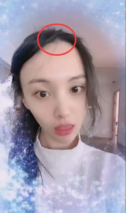 被怼显老脸崩后,郑爽晒自拍化身白雪公主,肤白貌美,发际线成新问题