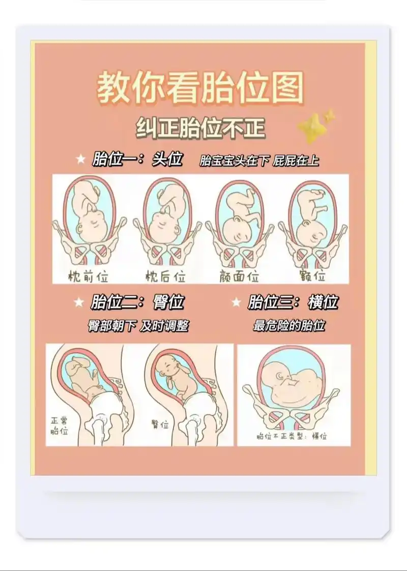 几周开始头位啊? 1月前·黑龙江 0 分享 回复 木子不是李～ 作者 .