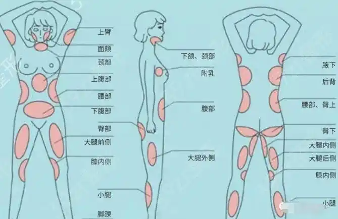 超脂塑可以作用域浅层的脂肪溶脂,可以马甲线,人鱼线,胸肌等比较完全