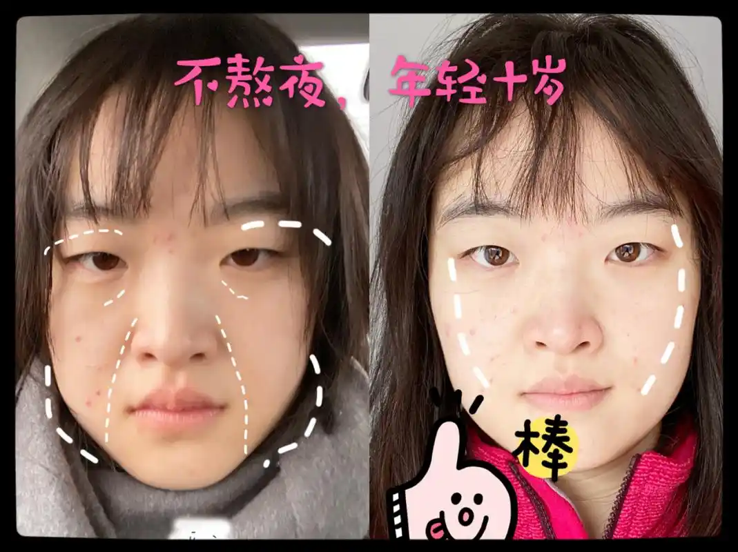 熬夜老十岁!前后两张照片,对比十分强烈!