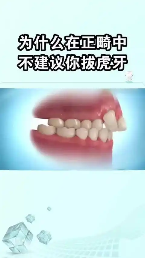 虎牙牙根长,起到支撑面部的作用