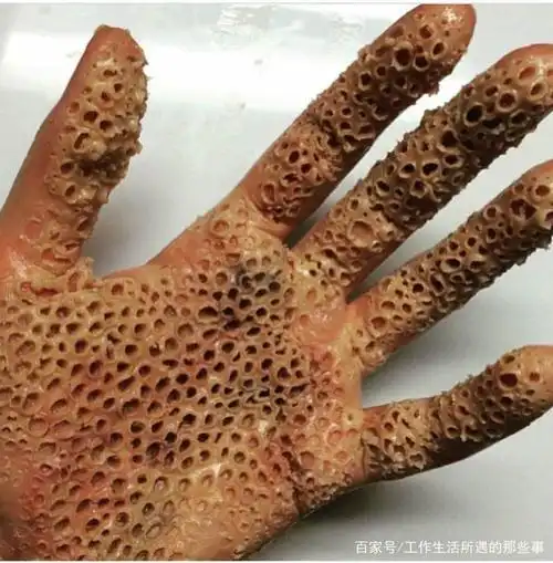 恐惧症(面对恐惧症不怕不怕啦)