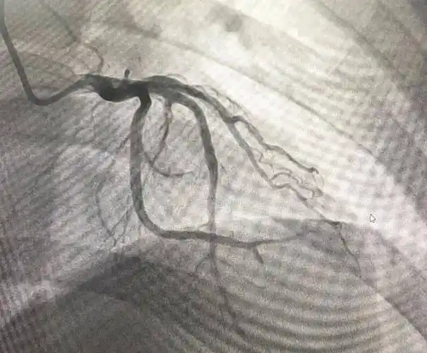 造影术的开展开创了我院心脏介入治疗的先河,标志着医院心血管内科在