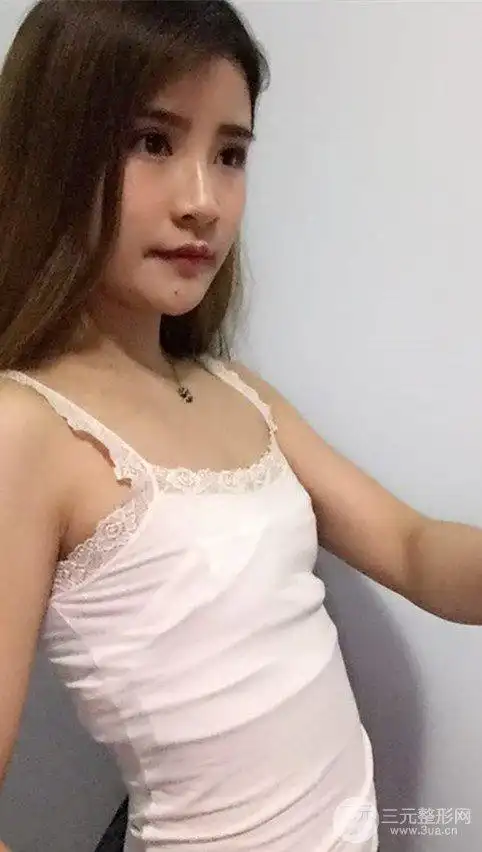 先看看我术前的胸吧,是不是超级平.