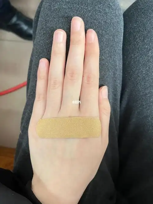 创可贴怎么贴