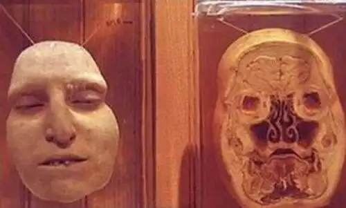 福尔马林是什么与尸体共舞的不腐之秘甲醛的水溶液