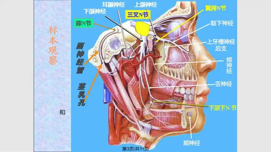特发性面神经麻痹ppt课件