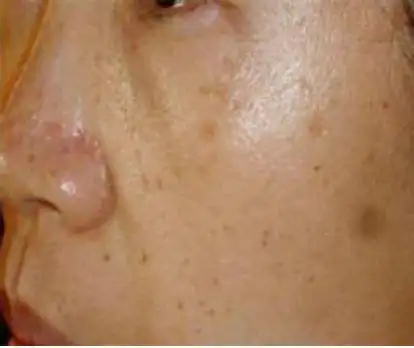 肤色发黄脸色发黄暗沉是什么原因引起的2022已更新今日动态