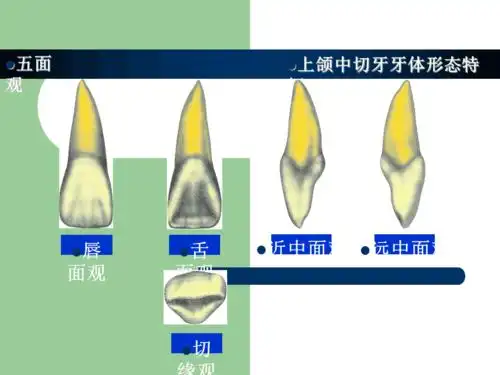 上颌中切牙形态特征简述