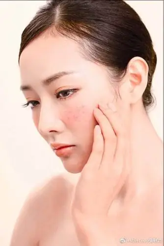 涂上化妆品皮肤就感到刺激是对化妆品过敏吗?