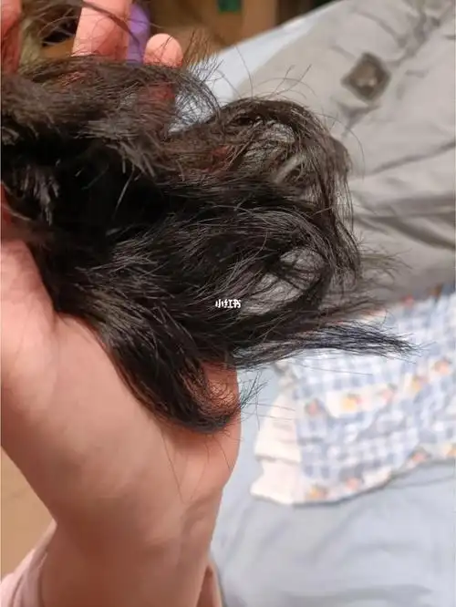 头发被烫焦了怎么办