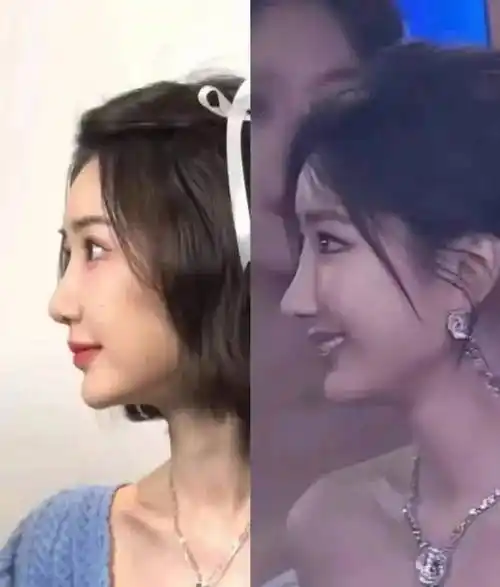 毛晓彤生图又变样,鼻子抢镜,今昔对比判若两人_盛典_长相_少女