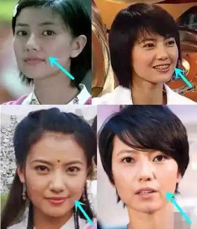 脸肿嘴变大,我们找到了高圆圆整形的实锤