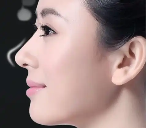 自体脂肪注射隆鼻可保持多久