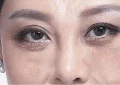 女人有悬针纹的寓意福浅命薄还克夫最不受欢迎的纹路