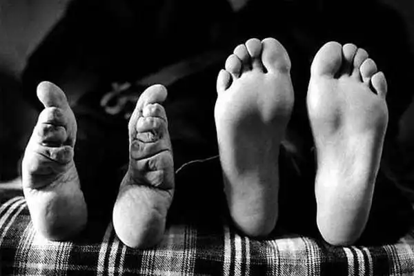 古代女子的三寸金莲是如何打造出来的发明这个的人有够残忍