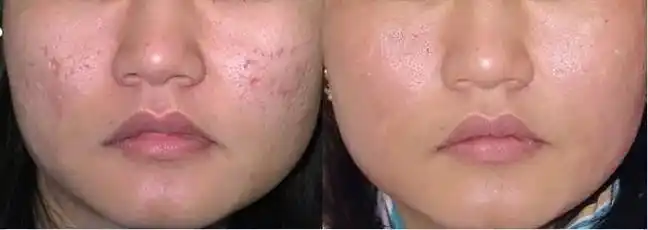 问题性皮肤管理 #皮肤问题  - 抖音