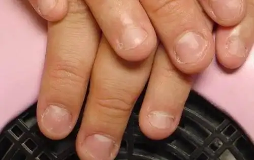 咬指甲是怎么回事 这些原因导致_苹果绿