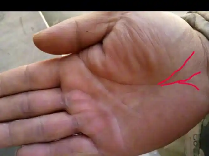 生命线末端分叉多,晚年体质差