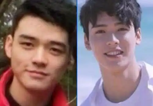 龚俊东华大学黑料天涯扒出整容前照片