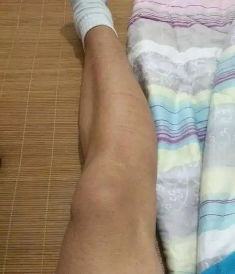 夜里腿脚抽筋该怎么办