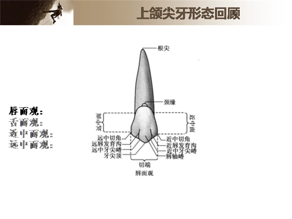 倍比雕刻上颌尖牙