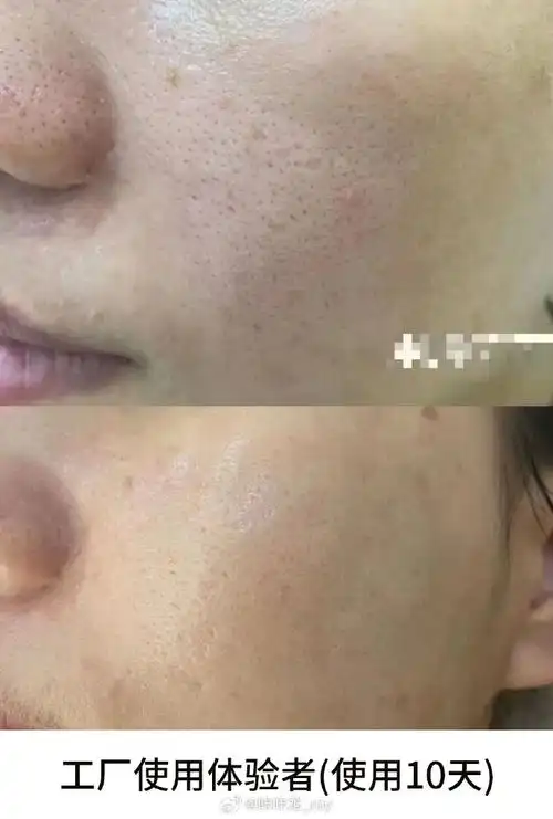 919191开会开会,当时微博体验收缩毛孔精华有四位姐妹,两位较