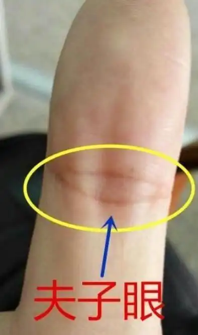 手上有"凤眼",不是人中龙凤就是富家手,注定一辈子不缺钱花!_纹路