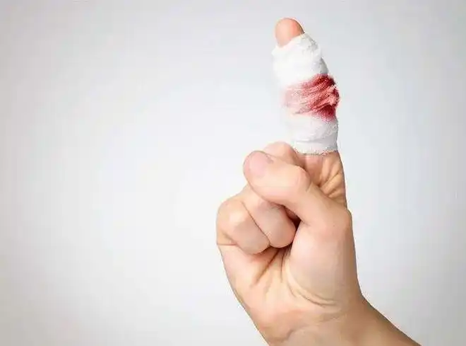 美女狠心剁掉自己手指头全场震惊了