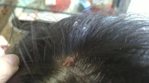 乐喜力丝:快来测测你有没有躺枪头皮敏感吧!