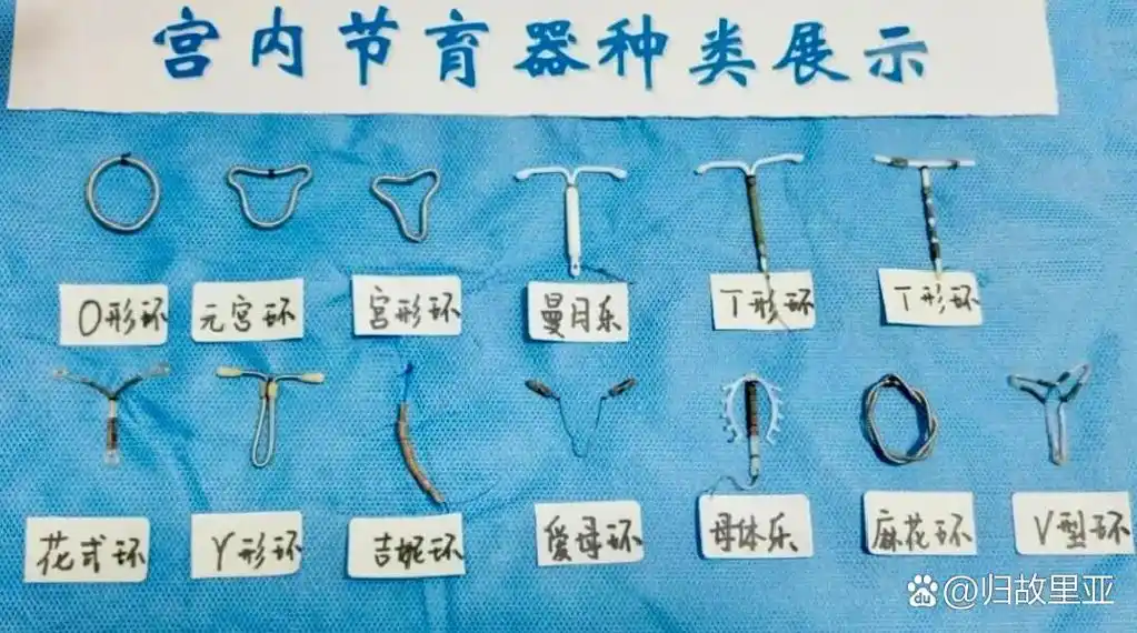 是一种放置在子宫腔内的避孕装置,由于初期使用的装置多是环状的,通常