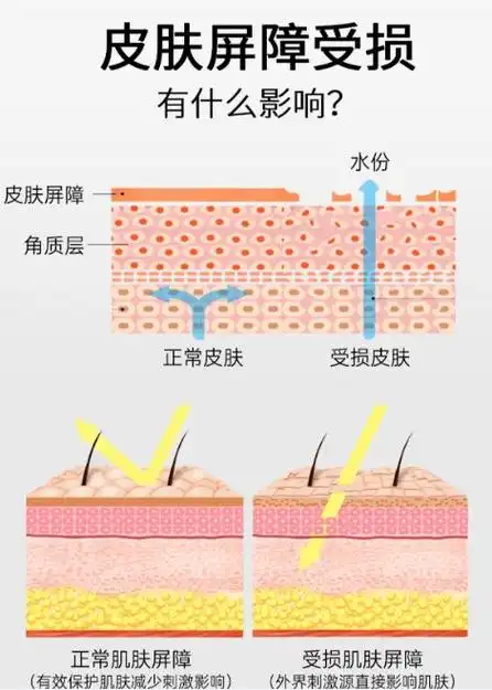 皮肤屏障是皮肤表面的一层保护膜,它就是皮肤防御外敌的「长城」,能够