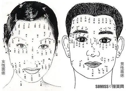 耳朵后有痣的图