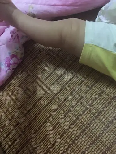 宝宝腿很弯是正常的嘛,不知道以后会不会变.好担心_百度宝宝知道