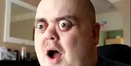 铜仁八中学生:长期戴眼镜,会让眼睛变形|近视|散光|高度近视|眼轴