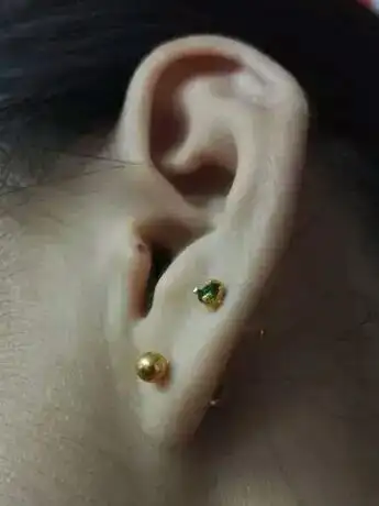 耳屏上有痣代表什么