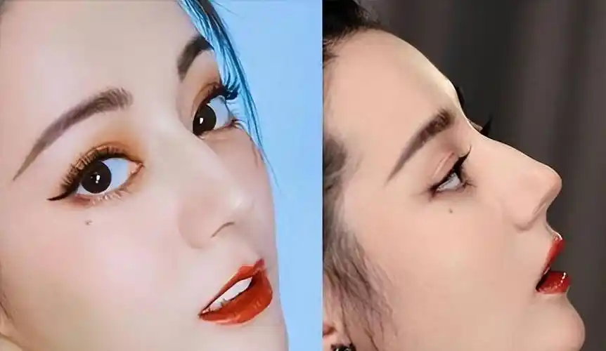 刘亦菲迪丽热巴侧颜仙图引爆骨相美,但盲目跟风做鼻子不可取!